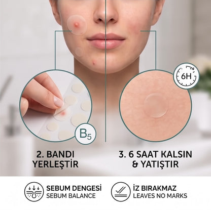 The Purest Solutions Hidrokolloid Akne Karşıtı & Yatıştırıcı Bant 36'lı