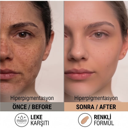 The Purest Solutions Cilt Tonu Eşitleyici ve Leke Karşıtı Blemish Defense Renkli Güneş Koruyucu Krem SPF 50, 50 Ml