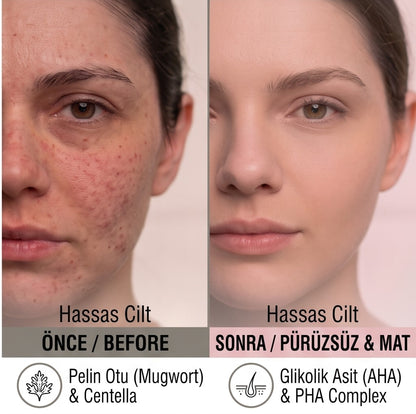 The Purest Solutions Hassas Ciltler İçin Arındırıcı ve Aydınlatıcı PHA Pembe Tonik 200 Ml